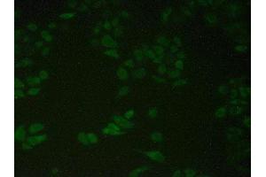 Detection of PDIA4 in Human Hela Cells using Polyclonal Antibody to Protein Disulfide Isomerase A4 (PDIA4) (PDIA4 抗体  (AA 505-636))