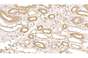 Detection of ACO1 in Human Kidney Tissue using Polyclonal Antibody to Aconitase 1 (ACO1) (Aconitase 1 抗体  (AA 26-243))