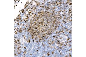Immunohistochemistry of paraffin-embedded human tonsil using CD20 antibody (ABIN7268472) at dilution of 1:100 (40x lens). (CD20 抗体)