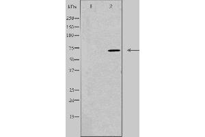 Western blot analysis of extracts from Jurkat cells, using DYR1B antibody. (DYRK1B 抗体  (Internal Region))