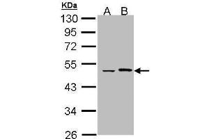 WB Image Sample (30 ug of whole cell lysate) A: Hela B: Hep G2 , 10% SDS PAGE antibody diluted at 1:1000 (EPHX1 抗体)