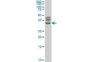 ATG3 monoclonal antibody (M06), clone 1F7 Western Blot analysis of ATG3 expression in Jurkat . (ATG3 抗体  (AA 1-100))