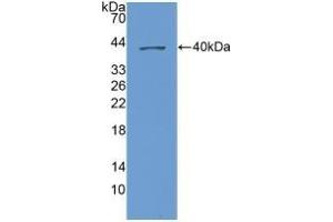 Detection of Recombinant NAP3, Human using Polyclonal Antibody to Chemokine (C-X-C Motif) Ligand 1 (CXCL1) (CXCL1 抗体  (AA 35-107))
