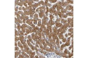 Immunohistochemical staining of human liver with GAB3 polyclonal antibody  shows moderate cytoplasmic positivity in hepatocytes. (GAB3 抗体)