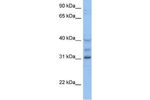 WB Suggested Anti-HOXD1 Antibody Titration:  0. (HOXD1 抗体  (C-Term))