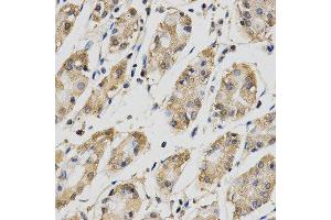 Immunohistochemistry (IHC) image for anti-Cell Division Cycle 34 (CDC34) antibody (ABIN1876645) (CDC34 抗体)