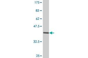 Western Blot detection against Immunogen (39. (FABP1 抗体  (AA 1-127))