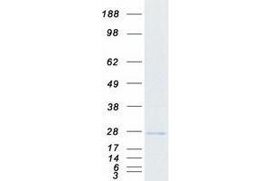 Western Blotting (WB) image for MIF4G Domain Containing (MIF4GD) protein (Myc-DYKDDDDK Tag) (ABIN2726012)