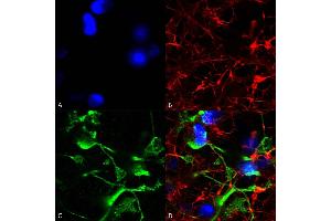 Immunocytochemistry (ICC) image for anti-ATP-Binding Cassette, Sub-Family C (CFTR/MRP), Member 9 (ABCC9) (AA 1505-1546) antibody (HRP) (ABIN2482980)