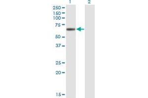 Western Blot analysis of LIPG expression in transfected 293T cell line by LIPG monoclonal antibody (M01), clone 4A9. (LIPG 抗体  (AA 21-500))