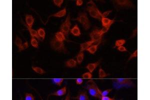 Immunofluorescence analysis of PC-12 cells using SERPINA1 Polyclonal Antibody at dilution of 1:100 (40x lens). (SERPINA1 抗体)