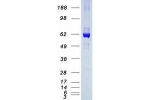Western Blotting (WB) image for Carboxylesterase 2 (CES2) (Transcript Variant 1) protein (Myc-DYKDDDDK Tag) (ABIN2713932)