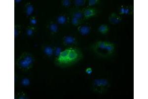 Anti-FSHB mouse monoclonal antibody (ABIN2453052) immunofluorescent staining of COS7 cells transiently transfected by pCMV6-ENTRY FSHB (RC214616). (FSHB 抗体)