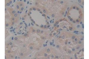 DAB staining on IHC-P; Samples: Human Kidney Tissue (STAT2 抗体  (AA 616-849))
