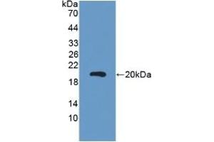 Detection of Recombinant CEA, Mouse using Polyclonal Antibody to Carcinoembryonic Antigen (CEA) (CEA 抗体  (AA 544-771))