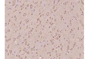 Immunohistochemistry (Paraffin-embedded Sections) (IHC (p)) image for anti-Lipoprotein-Associated phospholipase A2 (Lp-PLA2) (AA 301-441) antibody (ABIN686722)