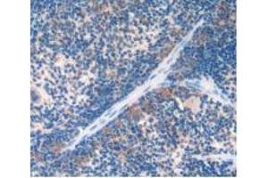 IHC-P analysis of Mouse Spleen Tissue, with DAB staining. (Urocortin 2 抗体  (AA 31-112))