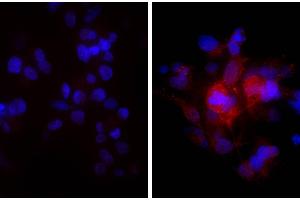 Human hepatocellular carcinoma cell line Hep G2 was stained with Rabbit Anti-Human DR5-UNLB and DAPI.