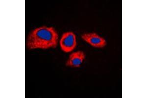 Immunofluorescent analysis of RPS4Y1 staining in K562 cells. (RPS4Y1 抗体  (C-Term))