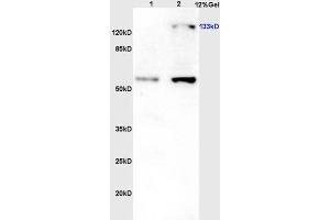 Lane 1: Rat brain lysates; Lane 2: Rat liver lysates probed with Rabbit Anti-eNOS (Thr113) Polyclonal Antibody (ABIN701245) at 1:300 overnight in 4 °C. (ENOS 抗体  (pThr113))