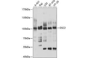 Western blot analysis of extracts of various cell lines, using DSC2 antibody (ABIN6127802, ABIN6139827, ABIN6139828 and ABIN6214372) at 1:1000 dilution. (Desmocollin 2 抗体  (AA 520-690))