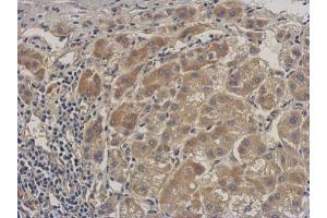 Immunohistochemistry (IHC) image for anti-Insulin-Like Growth Factor Binding Protein, Acid Labile Subunit (IGFALS) (C-Term) antibody (ABIN2855350)