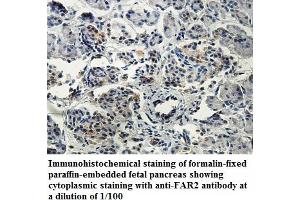Image no. 1 for anti-Fatty Acyl CoA Reductase 2 (FAR2) antibody (ABIN1576456)