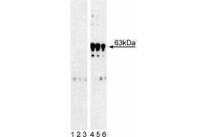 Western blot analysis of PDPK1 (pS241) in human T lymphocytes. (PDPK1 抗体  (pSer241))