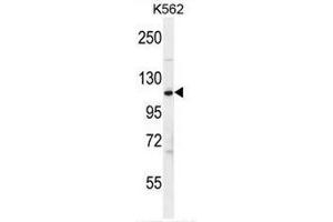 CFH Antibody (Center) western blot analysis in K562 cell line lysates (35µg/lane). (Complement Factor H 抗体  (Middle Region))