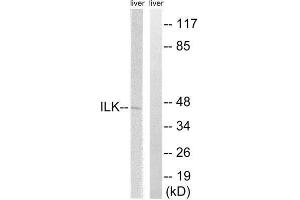 Western Blotting (WB) image for anti-Integrin-Linked Kinase (ILK) (Ser246) antibody (ABIN1848219) (ILK 抗体  (Ser246))