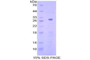 SDS-PAGE analysis of Human Adenylate Cyclase 5 Protein. (ADCY5 蛋白)