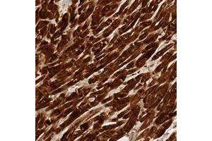 Immunohistochemical staining of human heart muscle with FREM2 polyclonal antibody  shows strong cytoplasmic positivity in myocytes at 1:10-1:20 dilution.