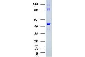 Western Blotting (WB) image for V-Akt Murine Thymoma Viral Oncogene Homolog 2 (AKT2) (Active) protein (Myc-DYKDDDDK Tag) (ABIN2714519)