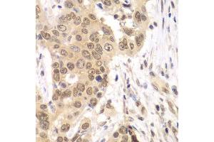 Immunohistochemistry (Paraffin-embedded Sections) (IHC (p)) image for anti-Ring Finger Protein 2 (RNF2) (AA 1-336) antibody (ABIN6147029)