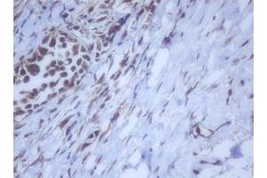 Image no. 5 for anti-DEAD (Asp-Glu-Ala-Asp) Box Polypeptide 59 (DDX59) (AA 1-303) antibody (ABIN1490728)