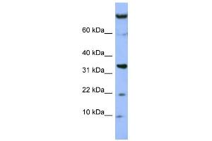 WB Suggested Anti-FAM178B Antibody Titration: 0. (FAM178B 抗体  (Middle Region))