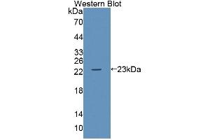 Western blot analysis of the recombinant protein. (ABCA9 抗体  (AA 1422-1589))