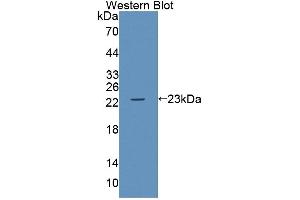 Western blot analysis of the recombinant protein. (ABCA9 抗体  (AA 1422-1589))