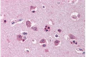 Human Brain, Cortex (formalin-fixed, paraffin-embedded) stained with HOMER1 antibody ABIN214115 at 5 ug/ml followed by biotinylated goat anti-rabbit IgG secondary antibody ABIN481713, alkaline phosphatase-streptavidin and chromogen. (HOMER1 抗体  (AA 101-150))