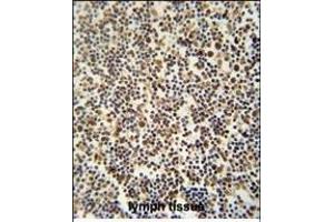 Immunohistochemistry (Paraffin-embedded Sections) (IHC (p)) image for anti-DENN/MADD Domain Containing 1B (DENND1B) (AA 39-68), (N-Term) antibody (ABIN654339)
