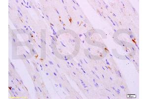 Formalin-fixed and paraffin embedded mouse heart tissue labeled with Anti-Cathepsin K Polyclonal Antibody, Unconjugated (ABIN732038) at 1:200 followed by conjugation to the secondary antibody, (SP-0023), and DAB staining (Cathepsin K 抗体)