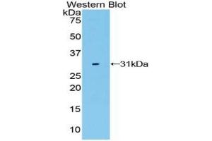 Western blot analysis of the recombinant protein. (LRP3 抗体  (AA 184-435))