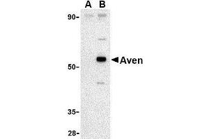 Western blot analysis of Aven in Raji cell lysate with AP30098PU-N Aven antibody at 1 μg/ml in (A) the presence and (B) the absence of blocking peptide. (AVEN 抗体  (C-Term))