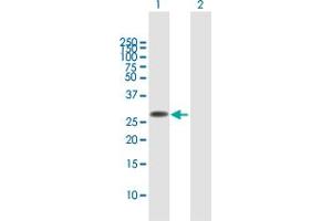 Western Blot analysis of FAM60A expression in transfected 293T cell line by FAM60A MaxPab polyclonal antibody. (FAM60A 抗体  (AA 1-221))