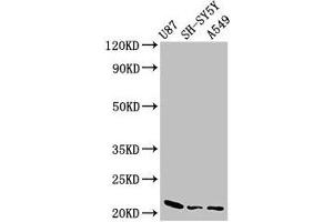 Western Blot Positive WB detected in: U87 whole cell lysate, SH-SY5Y whole cell lysate, A549 whole cell lysate All lanes: NDUFS4 antibody at 2. (NDUFS4 抗体  (AA 43-161))