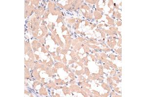 Immunohistochemistry of paraffin-embedded human stomach using ABCC1 antibody (ABIN6291733) at dilution of 1:100 (40x lens). (ABCC1 抗体)