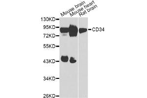 Western blot analysis of extracts of various cell lines, using CD34 Antibody (ABIN5975528) at 1/1000 dilution. (CD34 抗体)