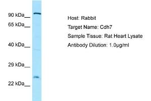 WB Suggested Anti-Cdh7 Antibody   Titration: 1. (Cadherin 7 抗体  (N-Term))