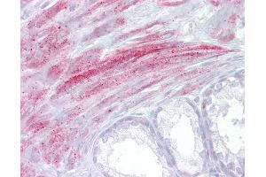 Immunohistochemistry (IHC) image for anti-Transient Receptor Potential Cation Channel, Subfamily M, Member 8 (TRPM8) (AA 251-300) antibody (ABIN959036)