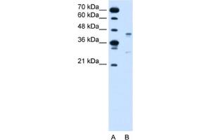 Western Blotting (WB) image for anti-G Protein-Coupled Receptor 161 (GPR161) antibody (ABIN2462573) (GPR161 抗体)